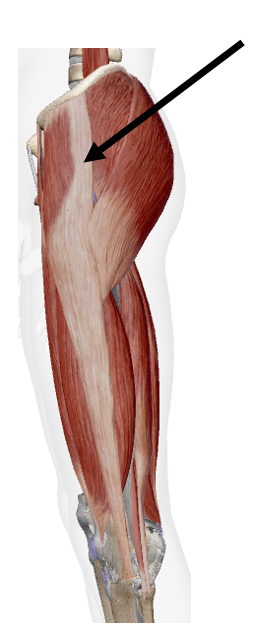 <p>Identify the name of the muscle that the arrow is pointing to in the image.</p>