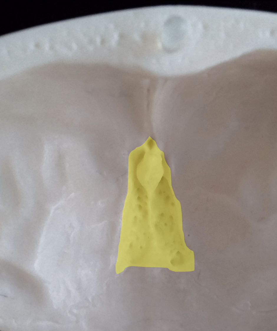 <p>What is the yellow region highlighted on the ethmoid bone?</p>