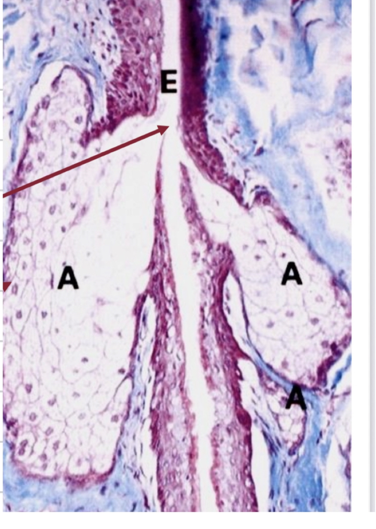 <ol><li><p>Holocrine secretion </p></li><li><p>Simple branched and alveolar </p></li><li><p>Mostly associated with hair follicles </p><ol><li><p>Basal cells CUBOIDAL AND ARE STEM CELLS with nuclei in the periphery ( the periperical part is darker and cumboidale </p></li><li><p>Differentiate into secretory cells </p></li><li><p>Move toawrds the center ( paler) accumulate lipid droplets</p></li><li><p>Cell dies and disentegrates into sebum </p></li></ol></li></ol><p></p>