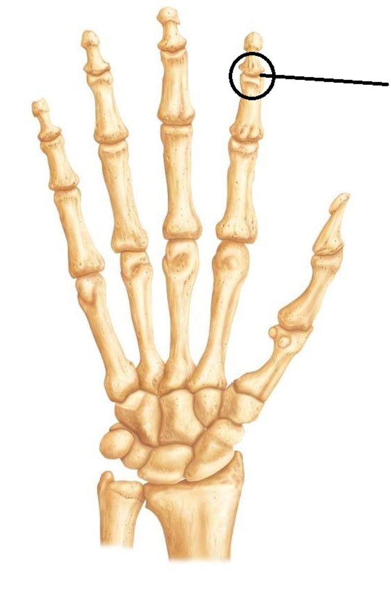 <p>Hinge Joints</p>