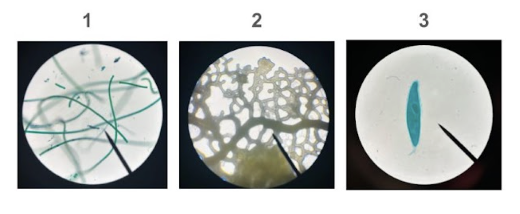 <p><span style="line-height: 1.5;"><br>27. Students at Columbus State Community College are observing three different specimen under the microscope. </span></p><p><span style="line-height: 1.5;">Which of the following represents the best conclusion that can be drawn based on their observations?</span></p><p><span style="line-height: 1.5;">A. Specimens 1 and 3 are eukaryotic</span></p><p><span style="line-height: 1.5;">B. Specimens 1 and 2 are prokaryotic</span></p><p><span style="line-height: 1.5;">C. Specimens 2 and 3 are photosynthetic</span></p><p><span style="line-height: 1.5;">D. Only specimen 2 is eukaryotic</span></p>