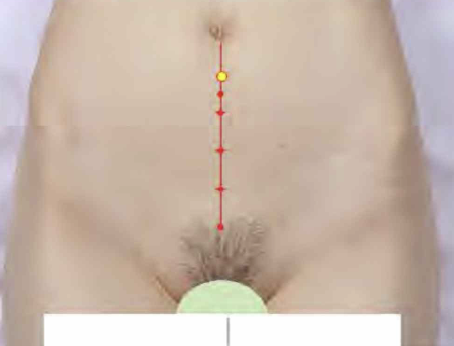 <p>앞정중선 위, 배꼽 중심 아래 1寸</p>