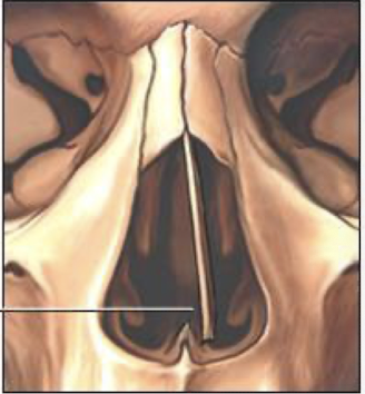 <p>What is this photo depicting?</p>