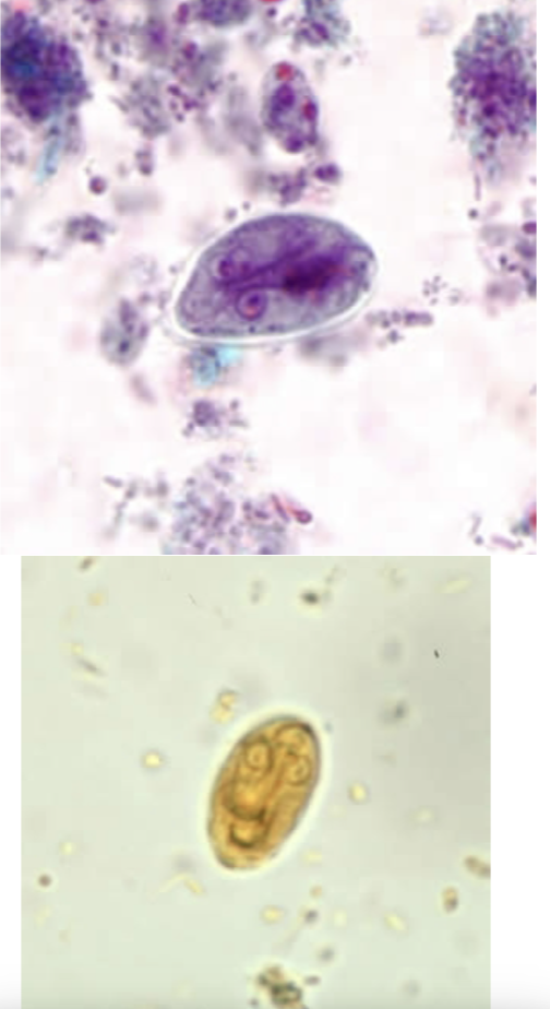 <p>-4 nuclei</p>