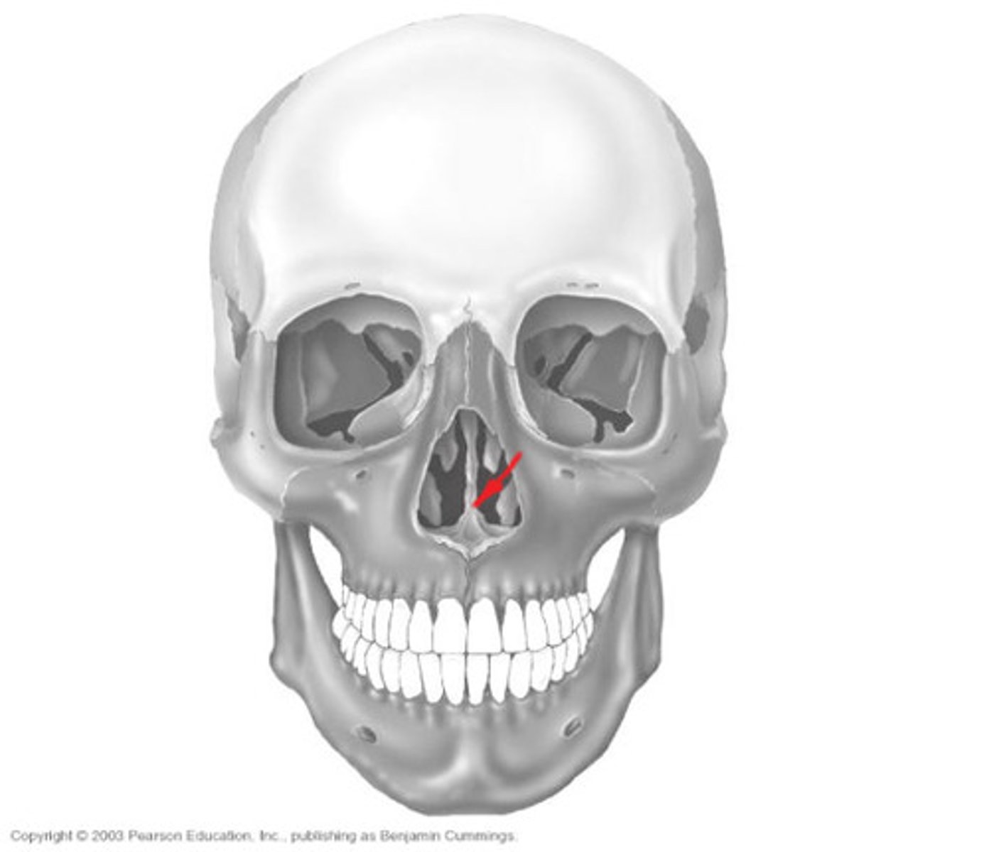 <p>ID BONE at arrow</p>
