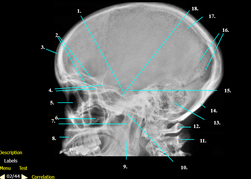<p>Label 16 - 18</p>