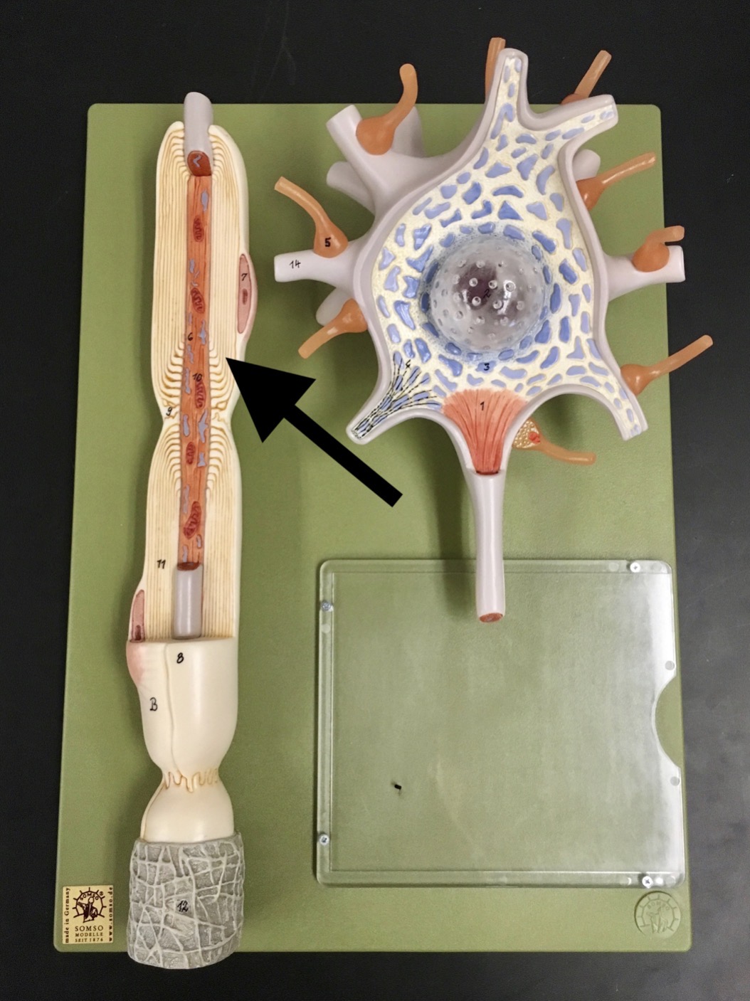 <p>What is the arrow pointing to?</p>