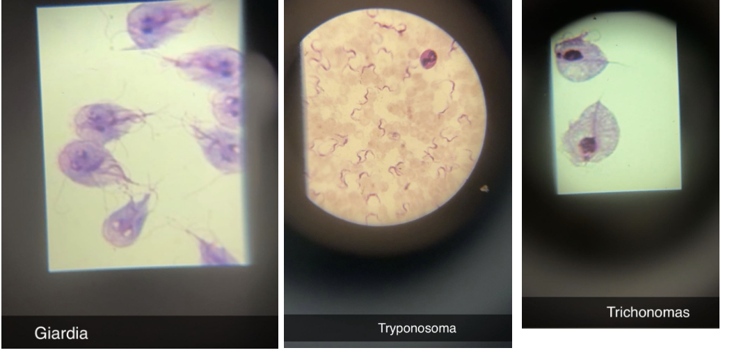 <p><span style="background-color: transparent; font-family: "Times New Roman", serif;">Euglena, Giardia, Trypanosoma, Trichomonas</span></p>