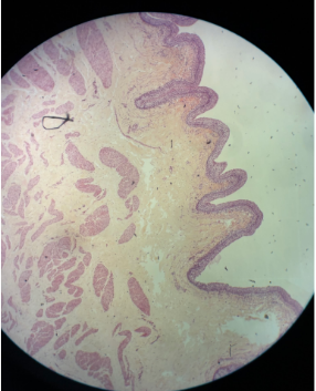 <p>What is the tissue shown and its epithelium</p>