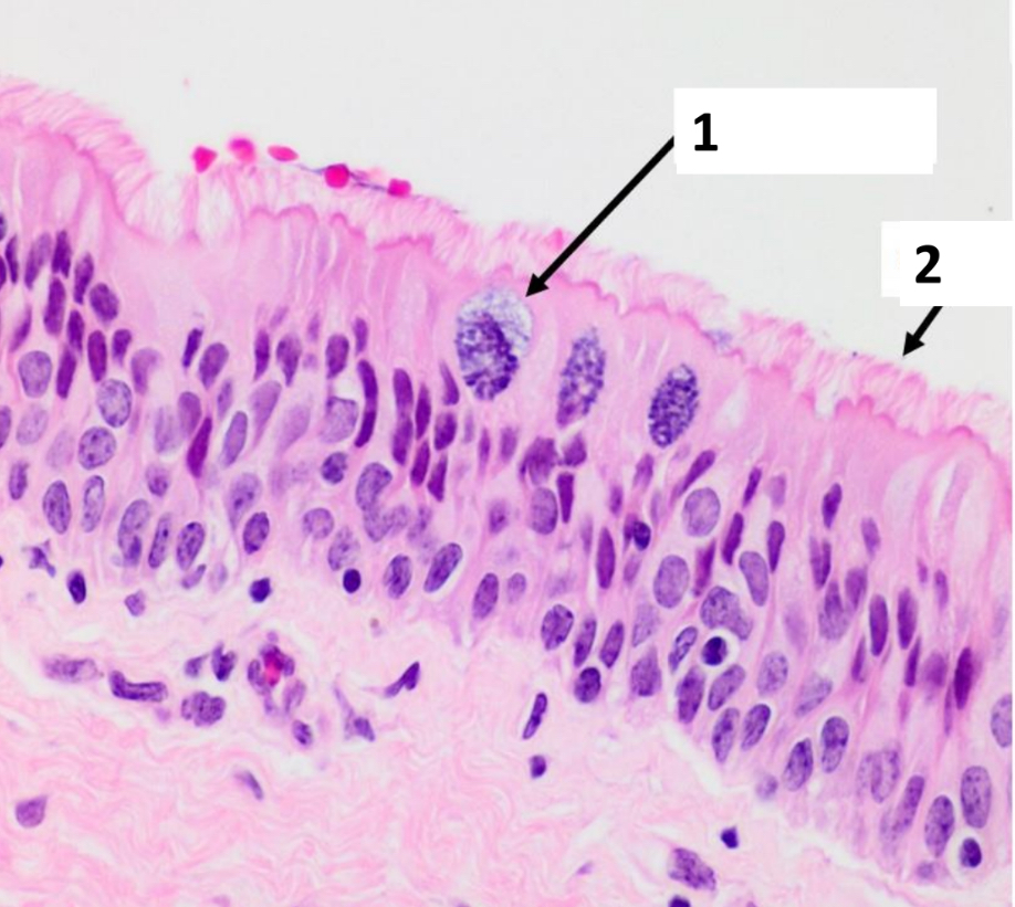 <p>Name the structure indicated by 2.</p>