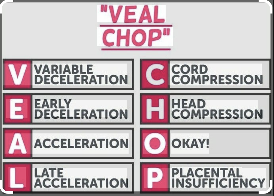 <p>causes of specific decelerations</p>