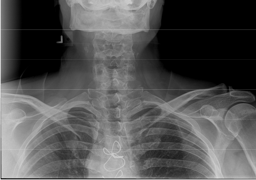 <p>Fix this image (AP Cervical)</p>