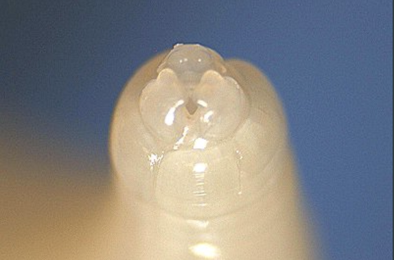 <p>what phylum does this belong to?</p>