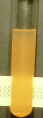 <p>Describe this joint fluid</p>