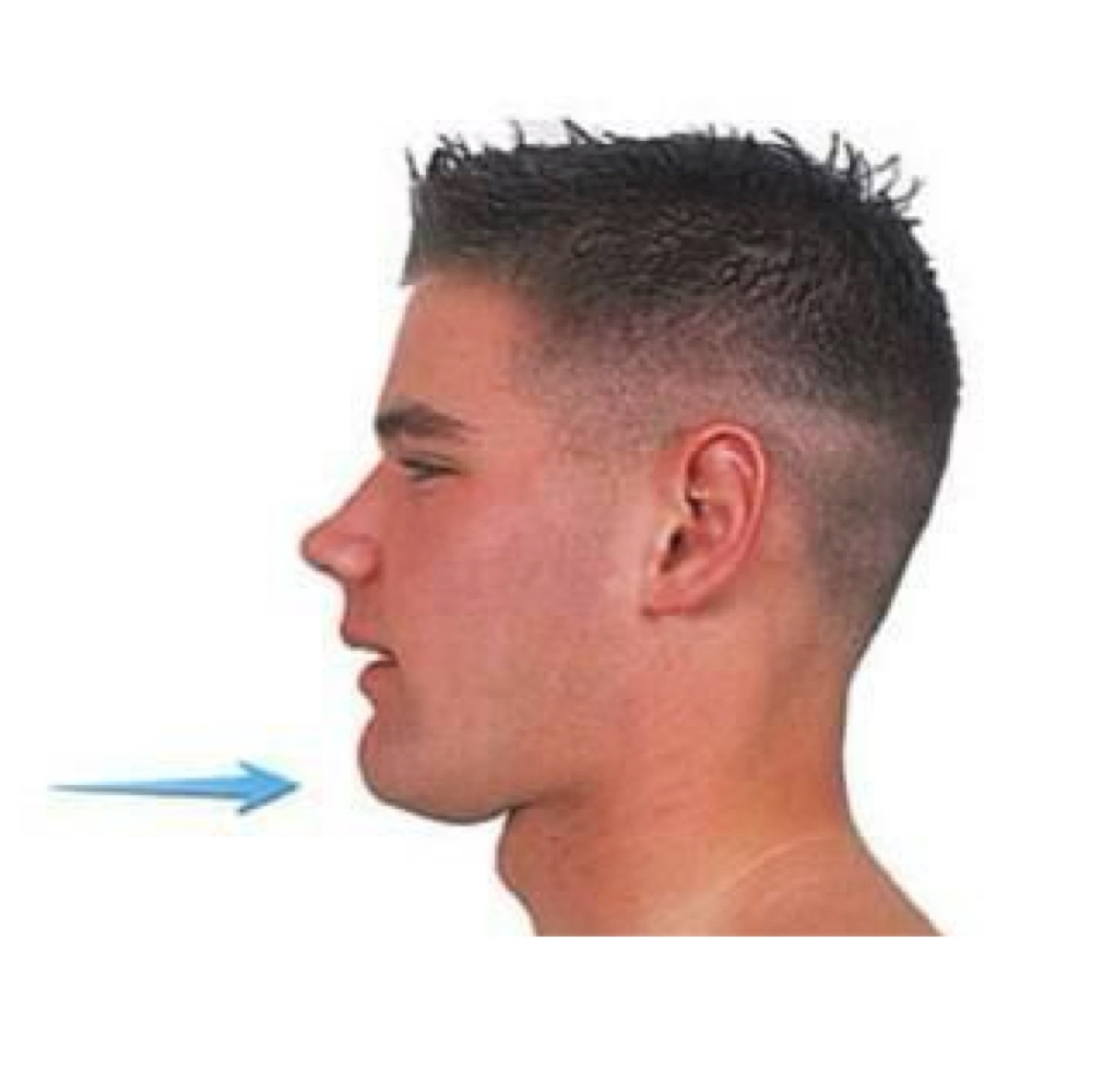 <p>name the muscle action</p>