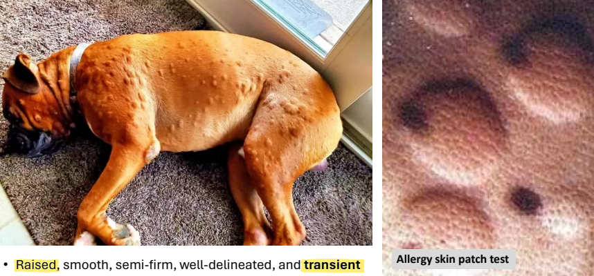 <ul><li><p><strong>primary lesion</strong></p></li><li><p><strong>raised</strong>, smooth, semi-firm, well-delineated, and <strong><u>transient</u></strong></p></li><li><p>edema → insect bites or allergy</p></li></ul><p></p>