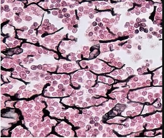 <p>Thick black fibers and special stain needed to see it (looks like alveolar sacs; usually found in lymphoid organs: lymph nodes, bone marrow, and spleen)</p><p>Function: Supports other cell types, protection </p>