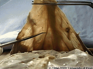 <p>what fold of the peritoneum located on the inner surface of the anterior abdominal wall is indictaed in the image?</p>