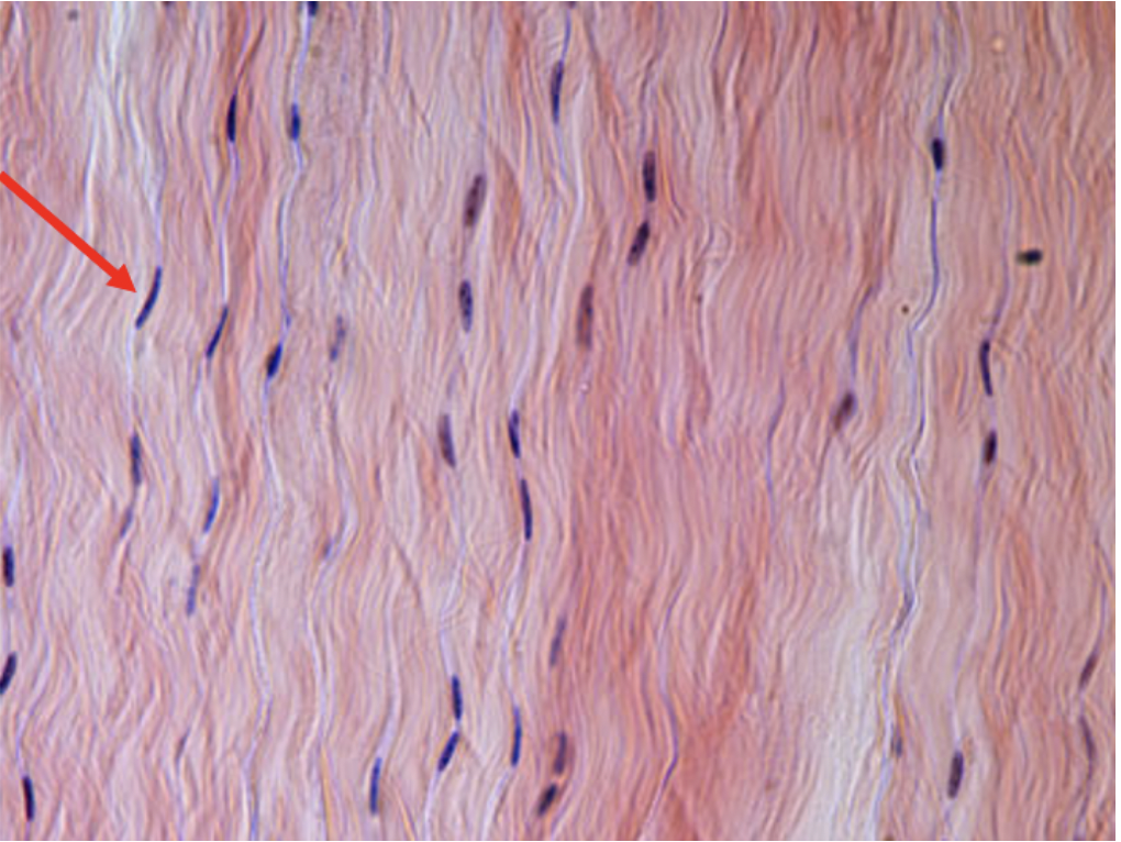 <p>Identify the fiber seen in this photo</p>
