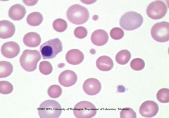 <p>nucleated RBC, immature</p>