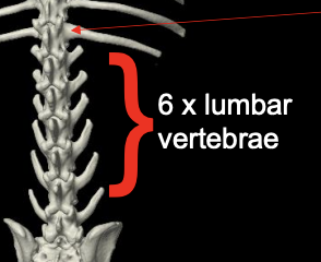 <p>What type of vertebrae have indeterminate characteristics and features of vertebrae from adjacent vertebral segments? They usually occur between segments: atlanto-occipital (fusion, additional bone), cervicothoracic (cervical rib), thoracolumbar (lumbar rib), lumbosacral (transitional vertebra - most common).</p>