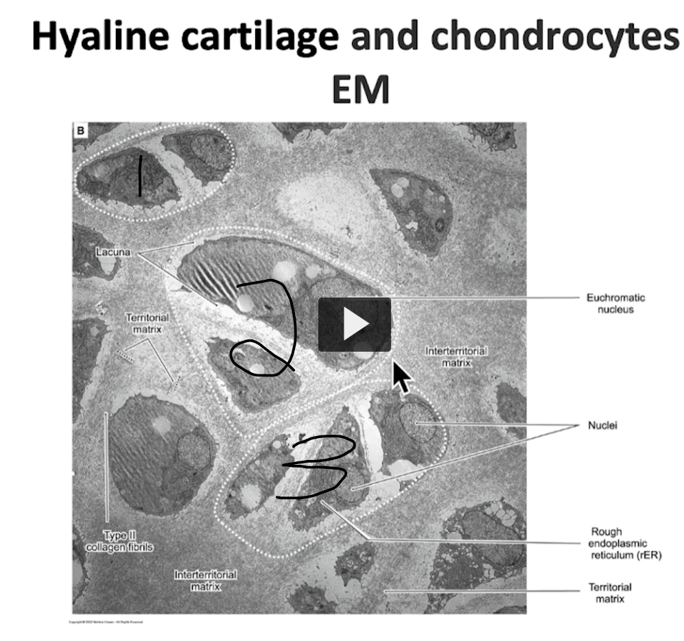 <p>Over here we can observe the interterritorial matrix and every group. Here we have an isogenous group, a second isogenous group, and a third isogenous group. Basically, you can see isogenous groups in any type of cartilage but they are better visualized in hylaline cartilage. It is more difficult to visualize elastic cartilage due to presence of elastic fibers, and it’s also difficult to visualize in fibrocartilage because it contains an abundant amount of collagen type I. </p>