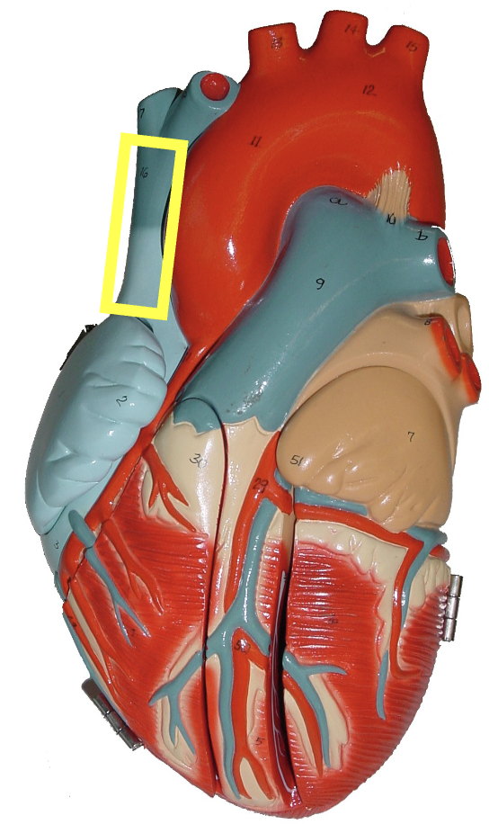 <p>what part of the heart muscle is shown?</p>
