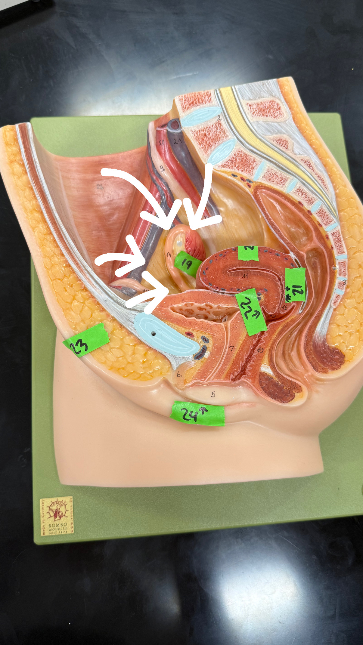<p>surrounding the ovary</p>