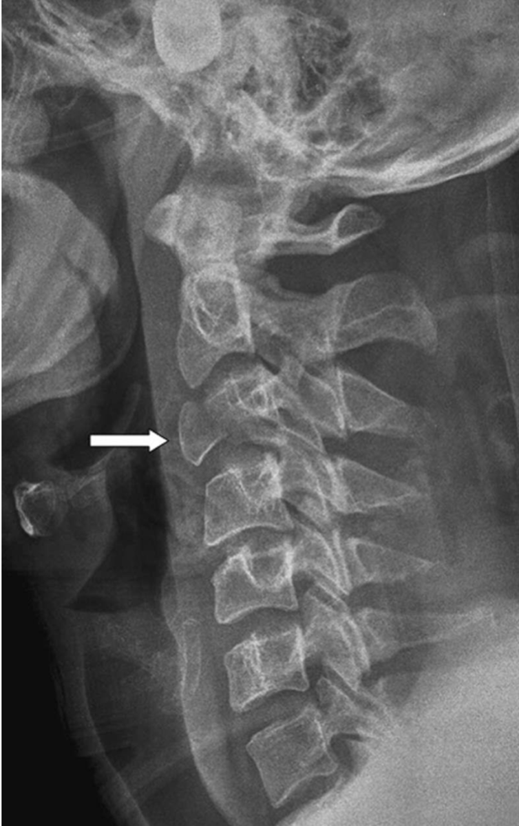 <p>What is the diagnosis?</p>