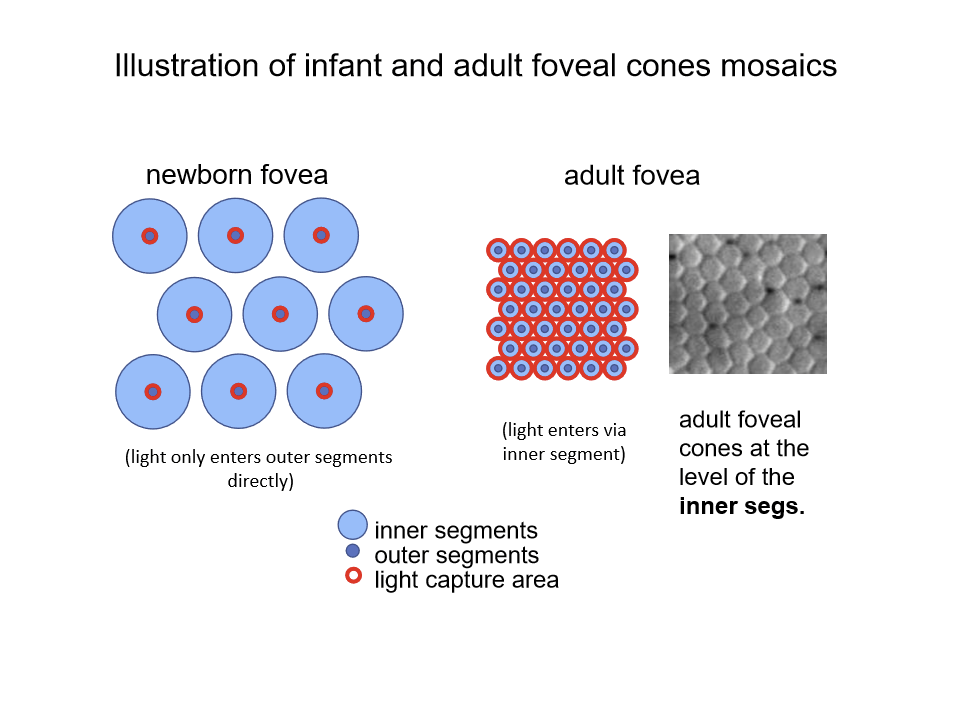 <p>In newborns, vision is limited because:</p><ul><li><p>There is little or no waveguiding</p></li><li><p>Much of the incident light does not reach cone outer segments</p></li><li><p>Short cone outer segments absorb less light</p></li></ul><p></p>