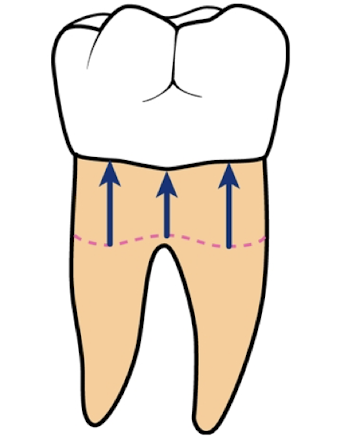 <p>What are stroke direction is this?</p>