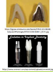 <ul><li><p>Used widely because of their<strong> optical similarities to teeth - shade, translucency, luster</strong></p></li><li><p><em>Brittle in nature</em> → microstructure and defects/flaws play a major role in determining strength</p></li></ul><ol><li><p>Excellent aesthetics </p></li><li><p>Biocompatibility </p></li><li><p>Chemical stability</p></li><li><p>Increasing use in digital dentistry</p></li><li><p>Widely used for crowns, veneers, inlays, onlays and implants</p></li></ol><p></p>