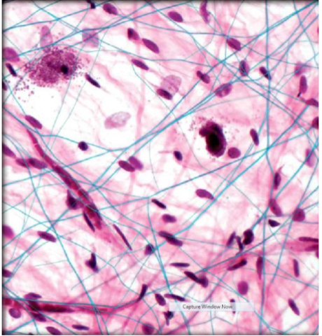 <p>Areolar Connective Tissue</p>