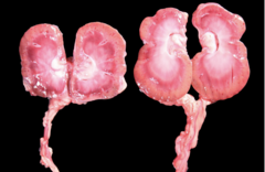 <p>Which chronicity is accurate for this lesion?</p>