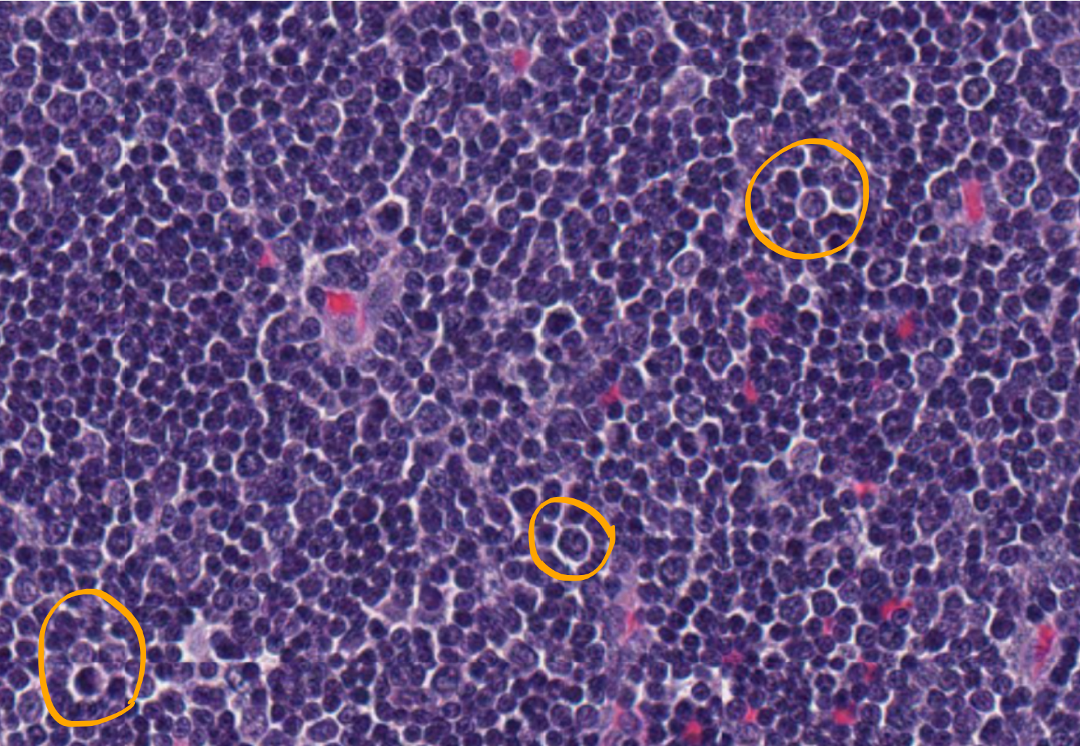 <p>What cells are circled in orange? (Canine Thymus)</p>
