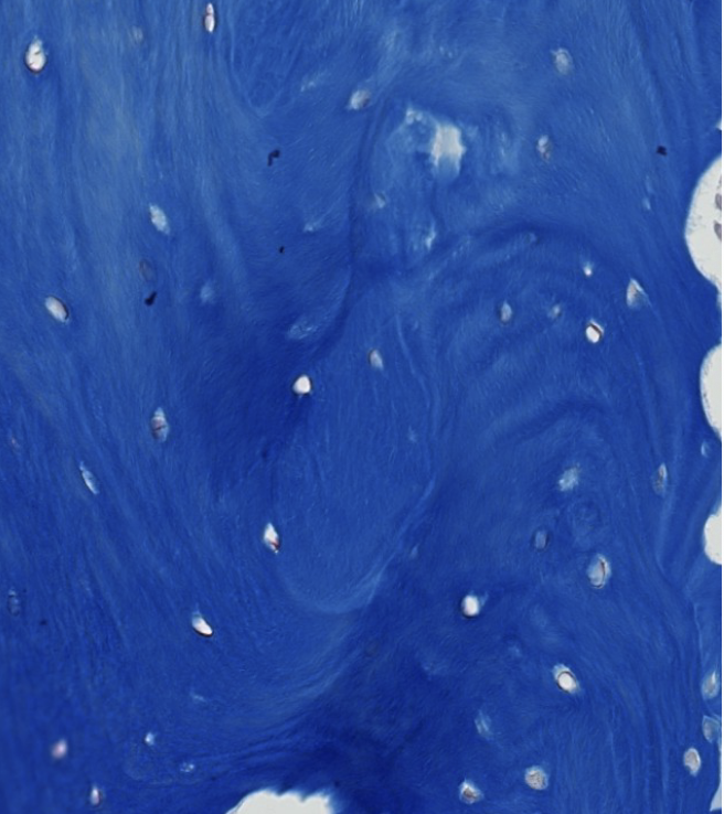 <p>what is the microscopic architecture of woven bone (how are the collagen fibers arranged)?</p>