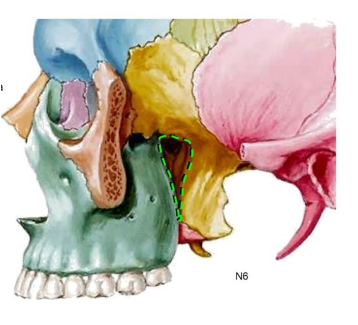 <p>pterygomaxillary fissure </p>