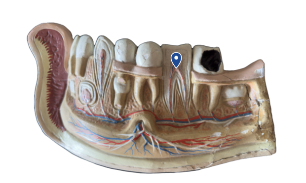 <p>Name this tooth type.</p>