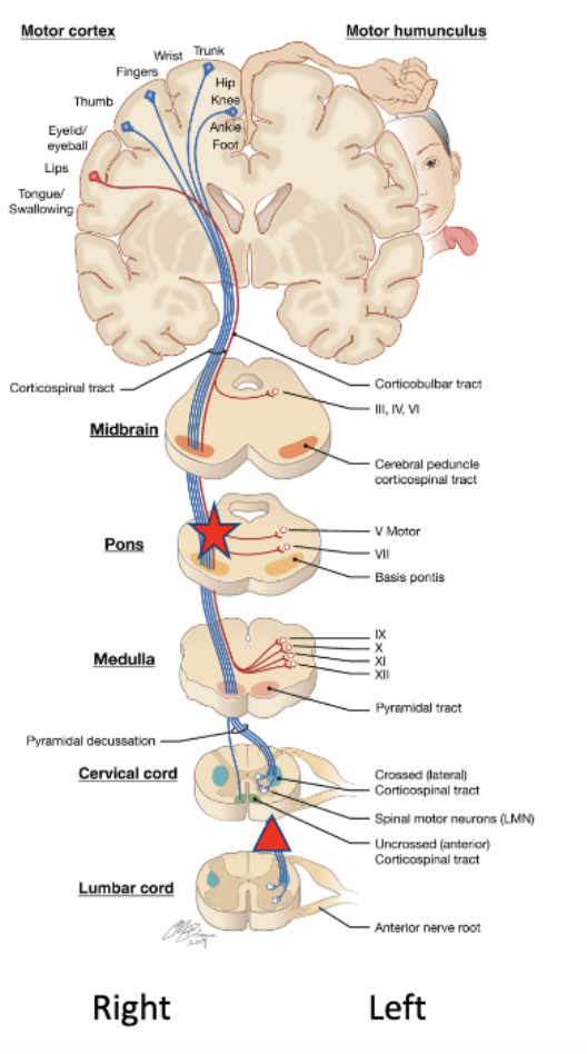<p>If there was damage approximately where</p><p>the triangle is, which side of the body (below</p><p>the neck) would be weak or paralyzed?</p>