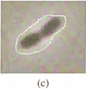 <p>Snakes are sensitive to initialization. Consider the initializations shown in the figure. What kind of problems could be expected in this  case, and can we add forces to the snake to counteract these problems?</p>