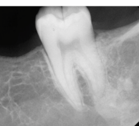 <p>25 male, no pain, no swelling, DDx?</p>