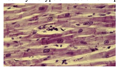 <p>What type of muscle is this?</p>