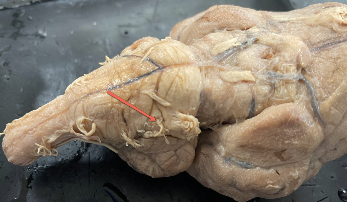<p><span>Identify the cranial nerve indicated by the pointer.</span></p>