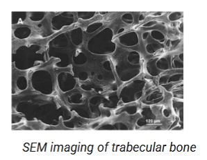 <p>In an SEM, an electron beam is directed at the surface of a sample. This beam excites atoms of the sample, emitting secondary photons which are received by the detector to form an image. It can produce 3D images</p>