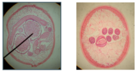 <p><span style="background-color: transparent;">Which of these slides is Male? Female? How can you tell?&nbsp;</span></p><p><span style="background-color: transparent;">What unique features are found in nematodes?</span></p>