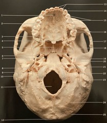 <p>What structure is #18? (Fig. 3.8 Cranium, Inferior View)</p>