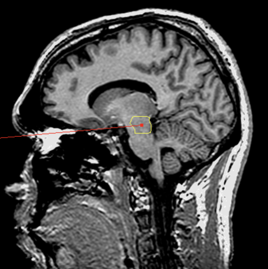 <p>What is the area highlighted called?</p>
