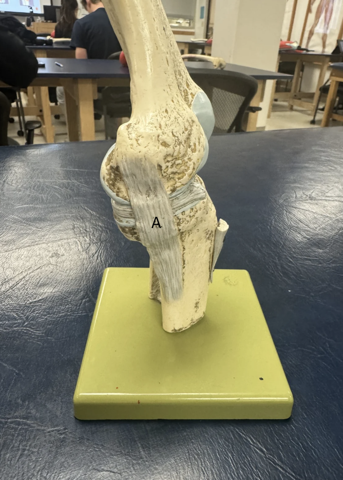 <p><span>Label this ligament</span></p>