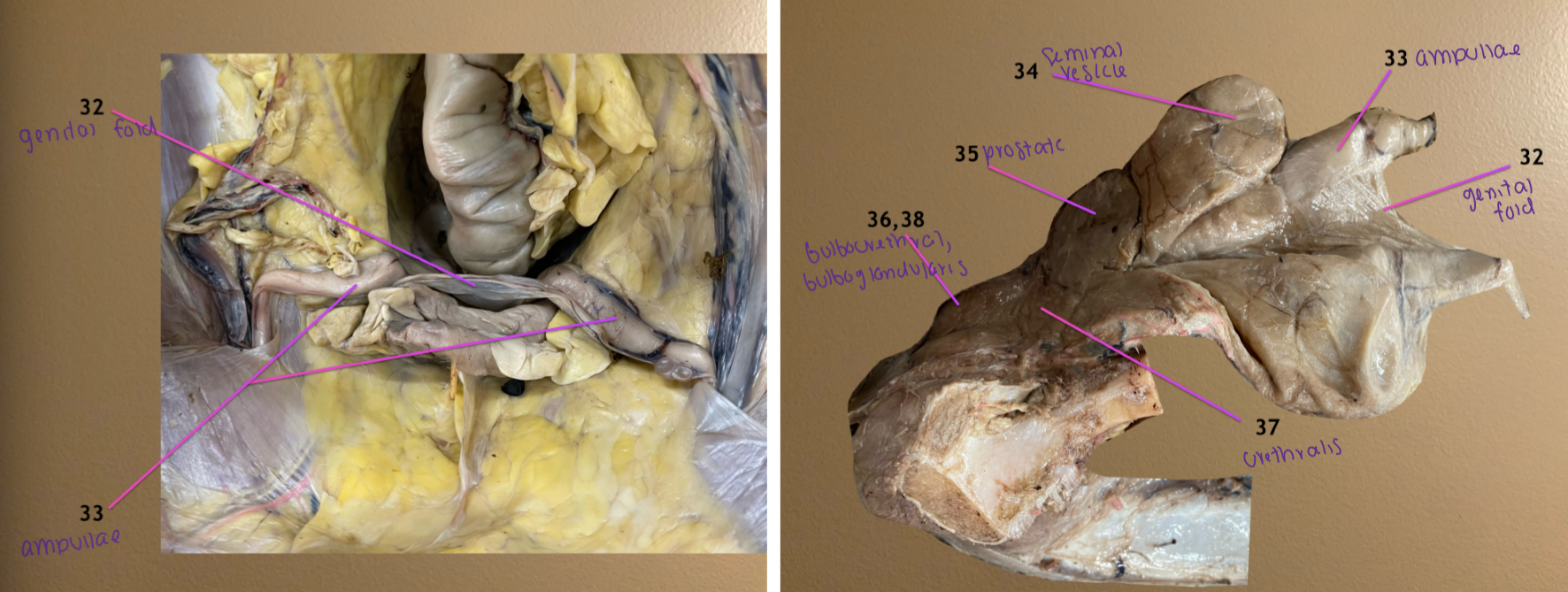 <ol start="32"><li><p>genital fold: contains 33 as they enter pelvic inlet</p></li><li><p>ampullae: dilated terminal end of DD</p></li><li><p>seminal vesicle: lateral to 32</p></li><li><p>prostate gland</p></li></ol><p>.</p><p><em>order of glands you feel during rectal palp (cd to cran): bulbourethral, prostate, seminal vesicle/ampullae</em></p>