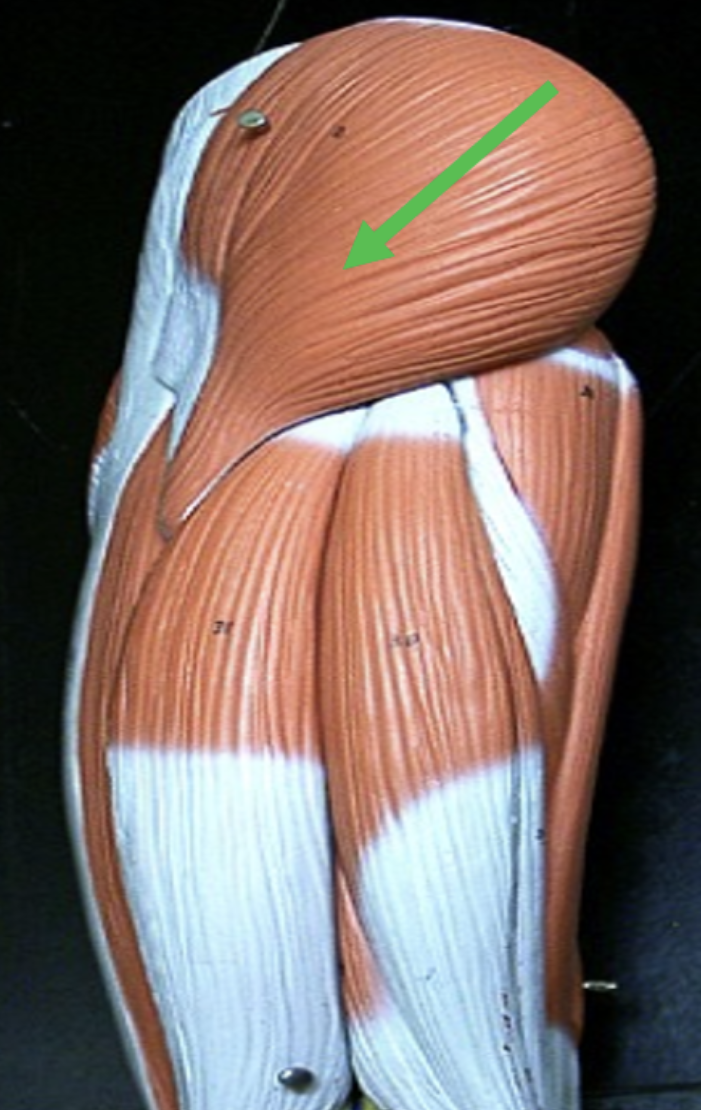<p>Identify the muscle indicated by the pointer.</p>